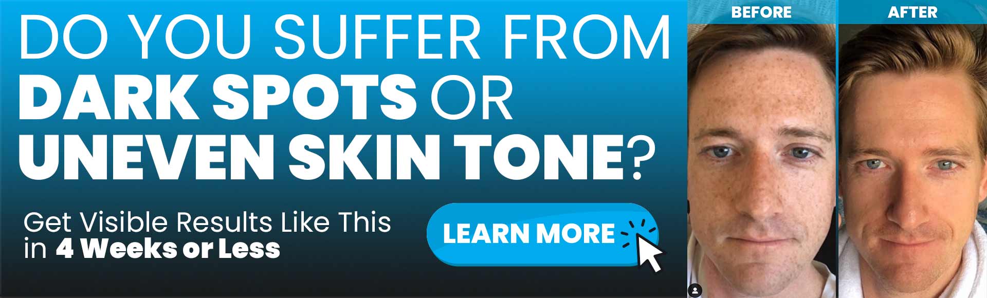 dark spots or uneven skin